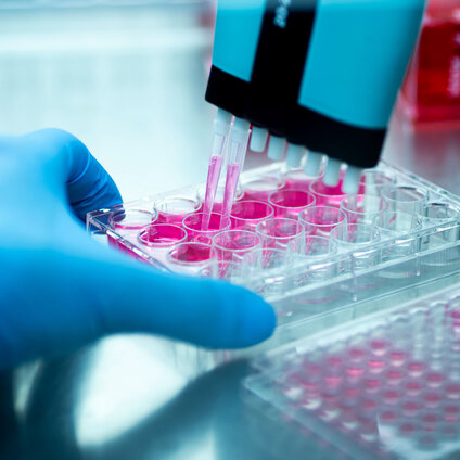Gloved hand handling tray and pipette with pink fluid (cell culture)